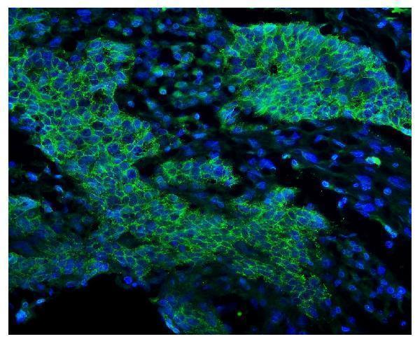 a00023 4 egfr primary antibodies if testing 6