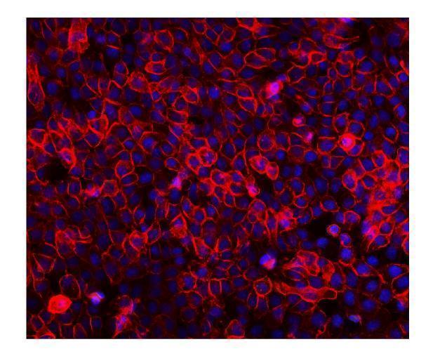 a00023 4 egfr primary antibodies if testing 7