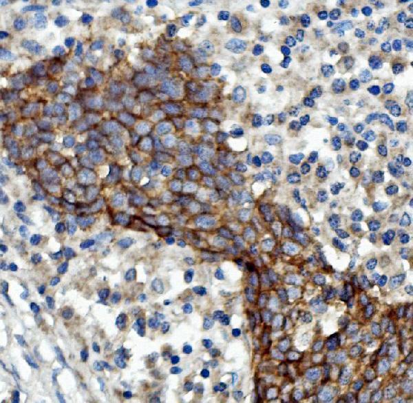a00023 4 egfr primary antibodies ihc testing 2