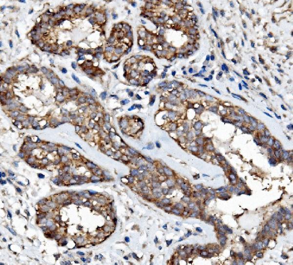 a00023 4 egfr primary antibodies ihc testing 3