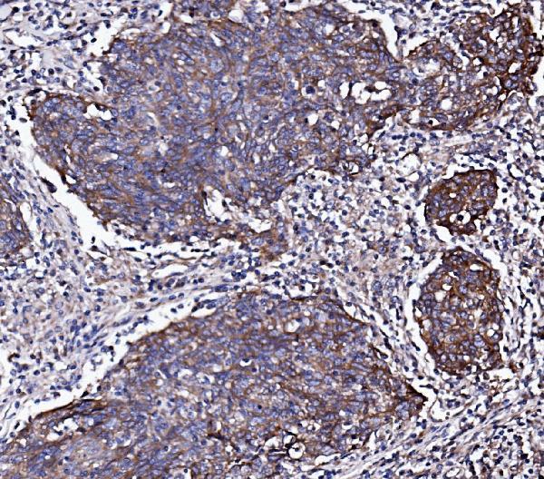 a00023 5 egfr primary antibodies ihc testing 2