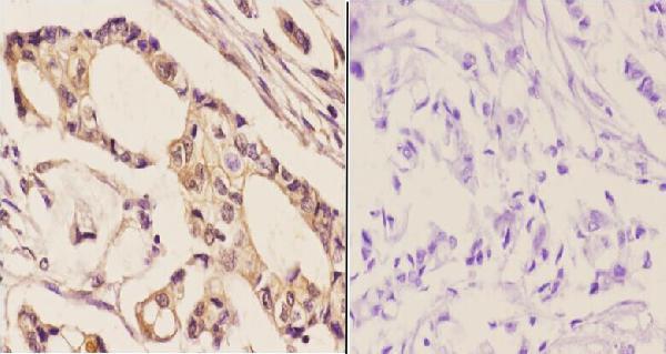 a00023s1046 egfr primary antiboties ihc testing 2