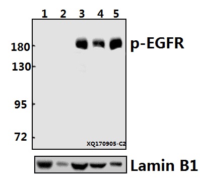a00023s1046 egfr primary antiboties wb testing 1