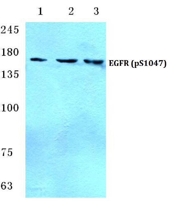a00023s1047 egfr primary antiboties wb testing 1