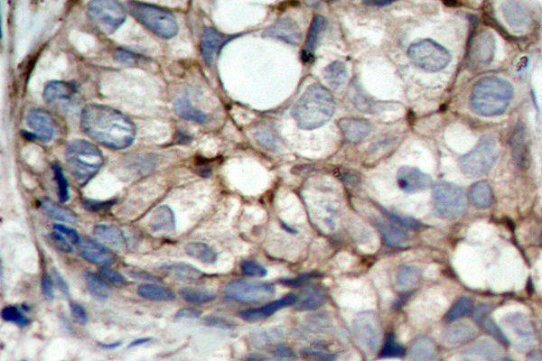 a00023s1064 egfr primary antiboties ihc testing 2