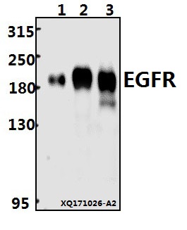 a00023s1104 egfr primary antiboties wb testing 1