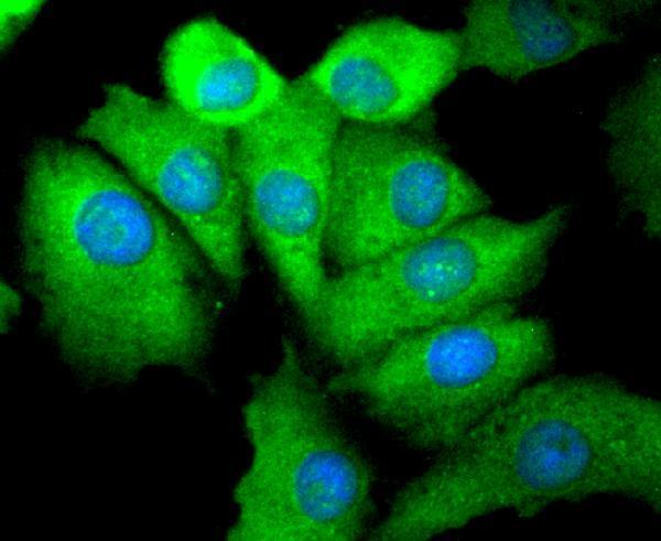 a00023s695 egfr primary antiboties icc testing 1