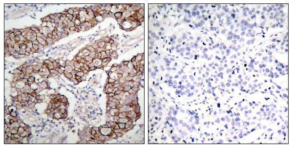 a00023y1092 1 egfr primary antibodies ihc testing 1