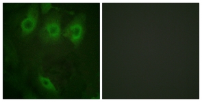 a00023y992 1 egfr primary antiboties if testing 3