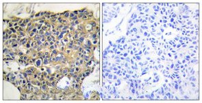a00023y992 1 egfr primary antiboties ihc testing 2