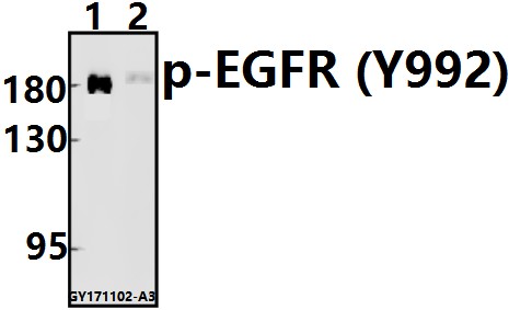 a00023y992 1 egfr primary antiboties wb testing 1