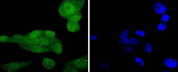 ICC staining Phospho-AKT1(S124) in PC-3M cells (green)