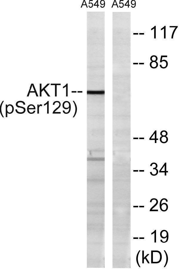 Western blot analysis of lysates from A549 cells treated with PMA 125ng/ml 30