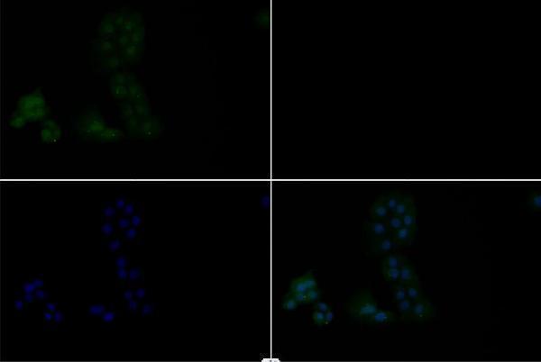 Immunofluorescence analysis of Hela cells using AKT (phospho-T308) pAb at dilution of 1:200