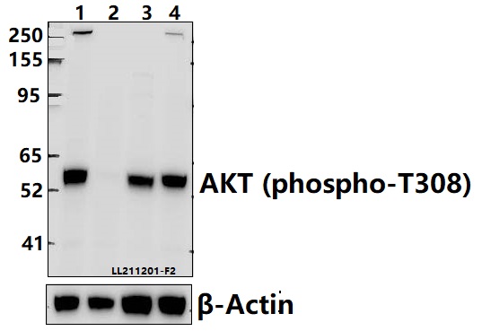 Western blot (WB) analysis of AKT (phospho-T308) polyclonal antibody at 1:5000 dilution
Lane1:HeLa whole cell lysate(40ug)
Lane2:Hela treated with λ-phosphatase whole cell lysate(40ug)
Lane3:PMVEC whole cell lysate(40ug)
Lane4:BV2 whole cell lysate(40ug)