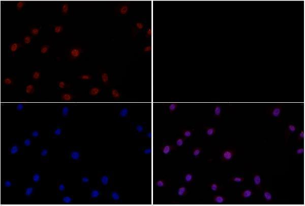 a00024t450 1 akt1 primary antiboties if testing 3