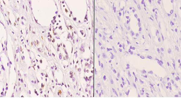 a00024t450 1 akt1 primary antiboties ihc testing 2