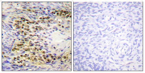 a00024t72 akt1 primary antibodies ihc testing 3