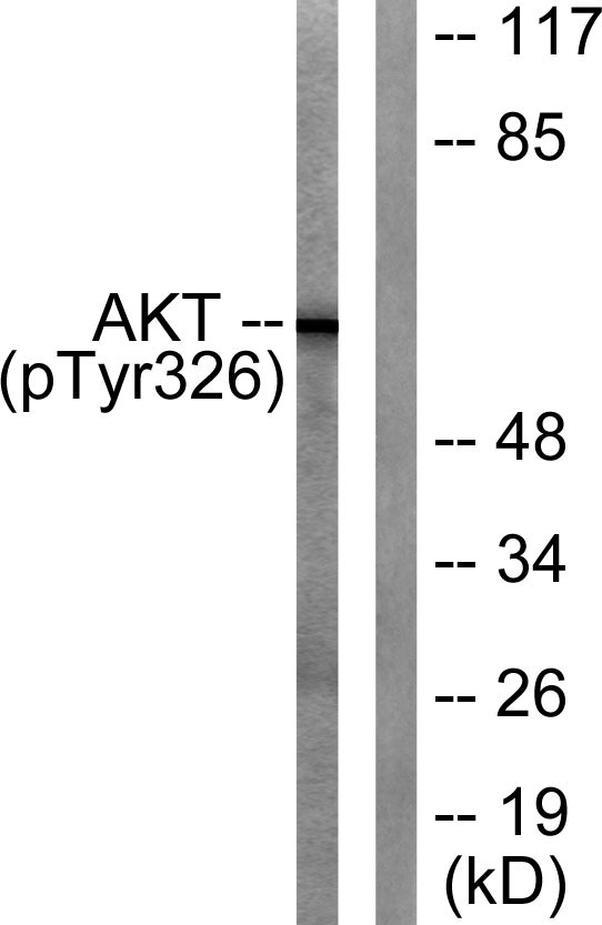 Western blot analysis of lysates from mouse liver, using Akt (Phospho-Tyr326) Antibody