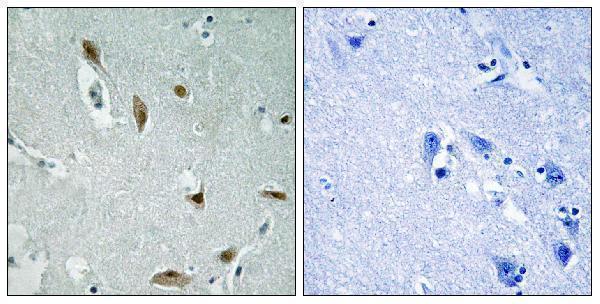 a00024y437 akt1 primary antibodies ihc testing 5