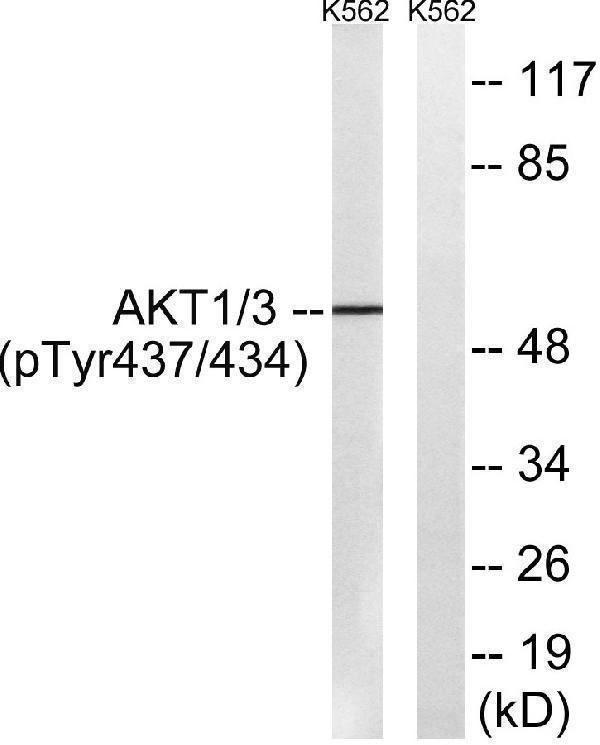 Western blot analysis of lysates from K562 cells treated with insulin 0