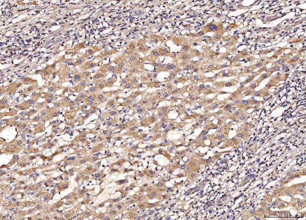  IHC analysis of MYD88 using anti-MYD88 antibody (A00025-3)