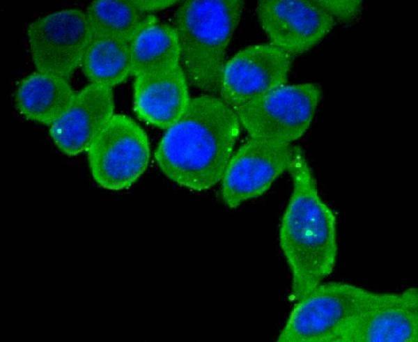 ICC staining MyD88 in HepG2 cells (green)
