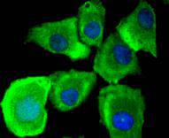 ICC staining MyD88 in A549 cells (green)