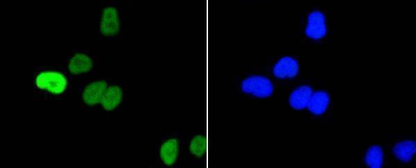 ICC staining Phospho-c-Myc(S62) in Hela cells (green)