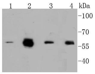 Western blot analysis of Phospho-c-Myc(S62) on different lysates using anti-Phospho-c-Myc(S62) antibody at 1/1,000 dilution