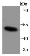 Western blot analysis of Phospho-c-Myc(T58+S62) on K562 cells lysates using anti-Phospho-c-Myc(T58+S62) antibody at 1/1,000 dilution