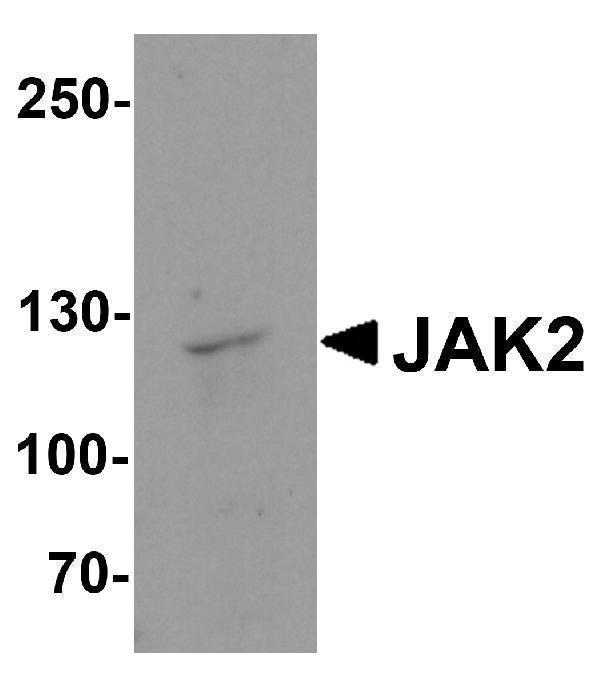 Western blot analysis of JAK2 in HeLa cell lysate with JAK2 antibody at 1 μg/ml