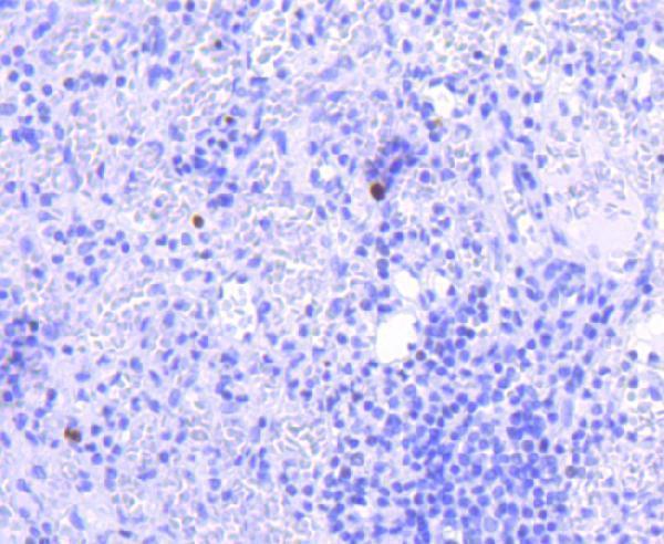 a00027y1007y1008 jak2 primary antiboties ihc testing 2