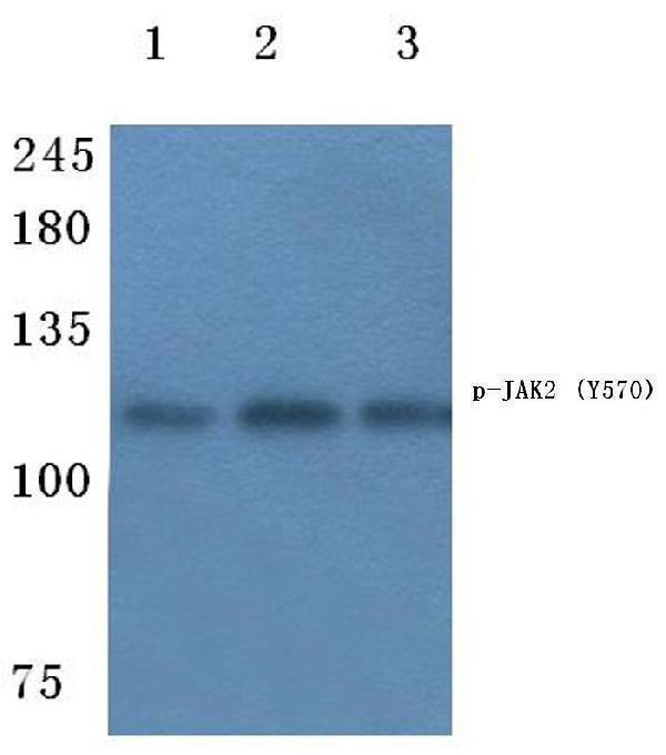 Western blot (WB) analysis of p-JAK2 (Y570) polyclonal antibody at 1:500 dilution
Lane1:Hela cell lysate
Lane2:NIH-3T3 cell lysate
Lane3:Rat kidney tissue lysate