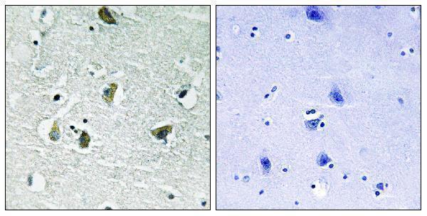 Immunohistochemistry analysis of paraffin-embedded human brain, using JAK2 (Phospho-Tyr931) Antibody