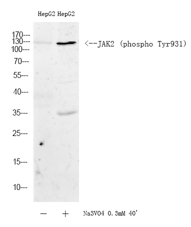 Western blot analysis of lysates from HepG2 cells treated or untreated with Na3VO4 0