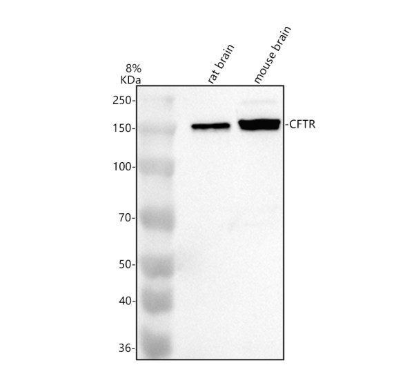 Western blot analysis of CFTR using anti-CFTR antibody (A00028-2)