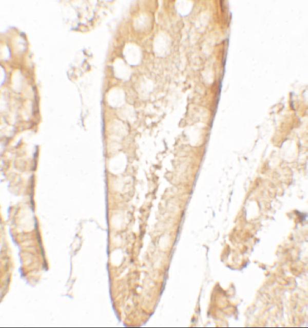 Immunohistochemistry of CFTR in human small intestine tissue with CFTR antibody at 5 μg/mL
