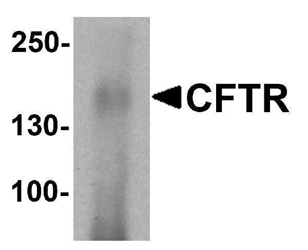 Western blot analysis of CFTR in human small intestine tissue lysate with CFTR antibody at 1 μg/ml