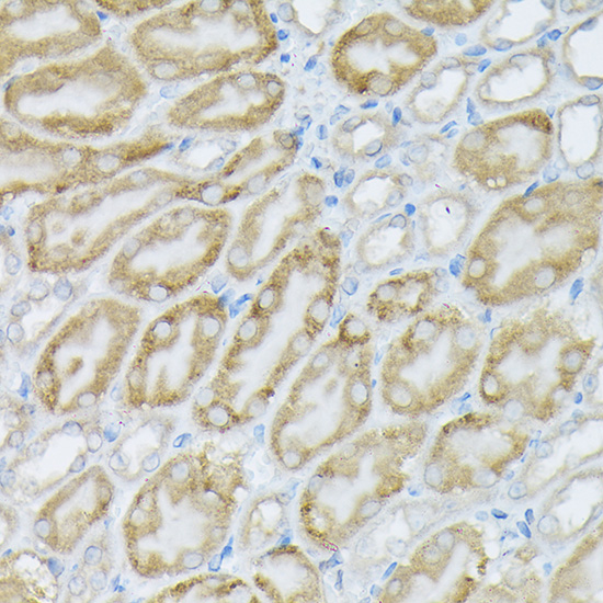WesternBlot (WB) analysis of PIK3CA polyclonal antibody