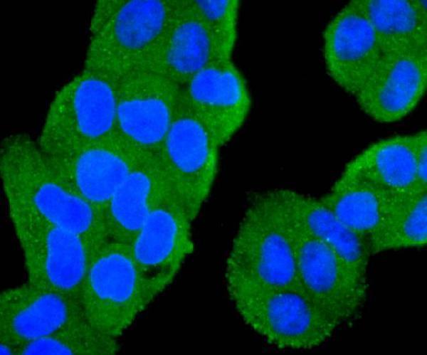 a00029 2 pik3ca primary antiboties icc testing 2