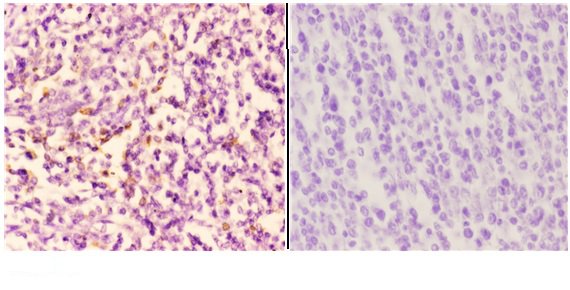 a00029 pik3ca primary antiboties ihc testing 2