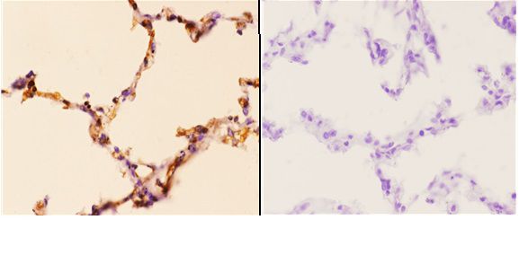 a00029 pik3ca primary antiboties ihc testing 3