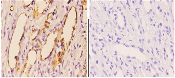 a00029 pik3ca primary antiboties ihc testing 4