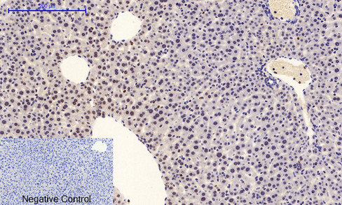 a00030y222 mapk1 primary antibodies if testing 7