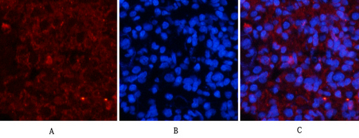 a00030y222 mapk1 primary antibodies if testing 9