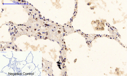 Immunohistochemical analysis of paraffin-embedded Human-Appendix tissue
