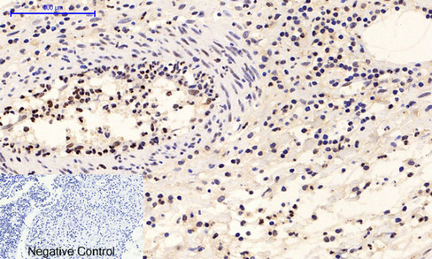 a00030y222 mapk1 primary antibodies ihc testing 5