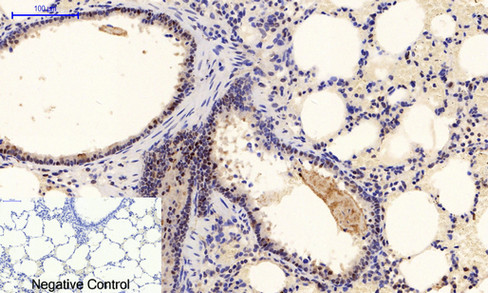 a00030y222 mapk1 primary antibodies ihc testing 6