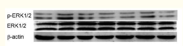 Western Blot analysis of KB cells using Phospho-ERK 1/2 (Y222/205) Polyclonal Antibody diluted at 1:500